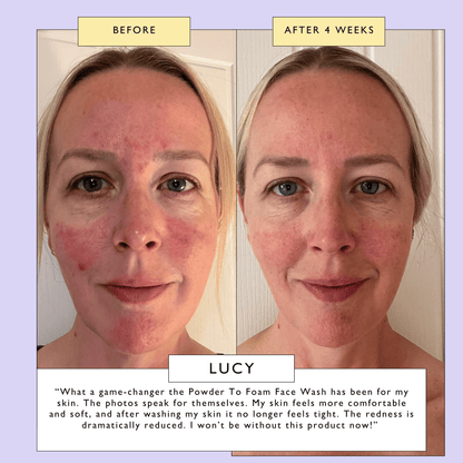 Powder To Foam Face Wash with Willow Bark + Papaya Enzymes